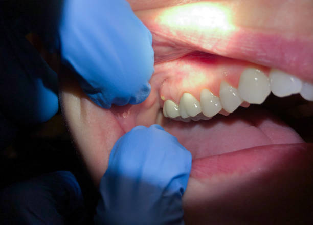 Best Emergency Orthodontic Repairs in Parchment, MI